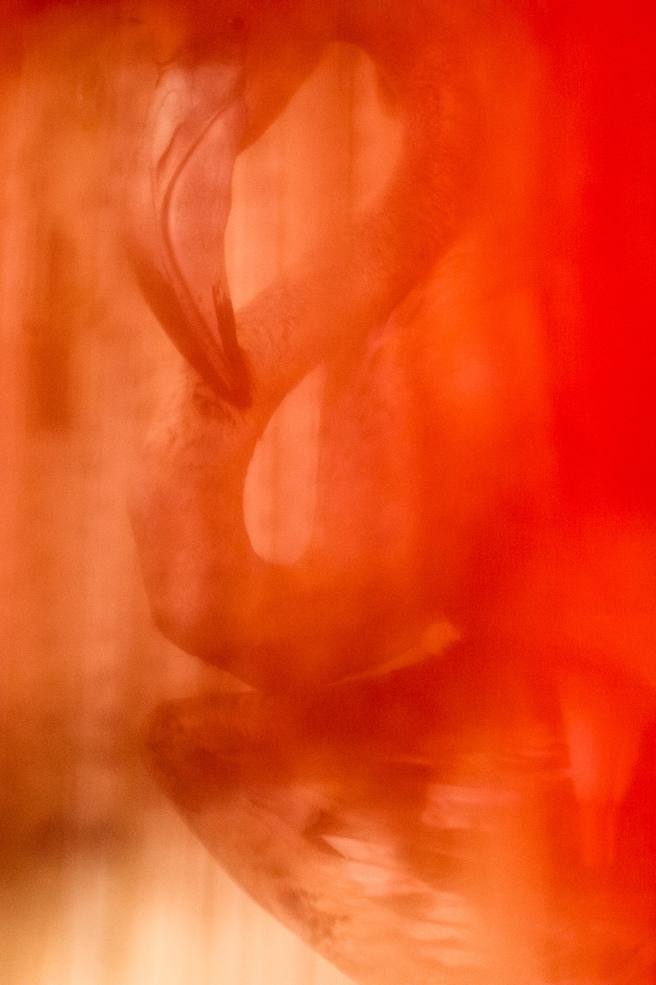 Convalescence Convalescence